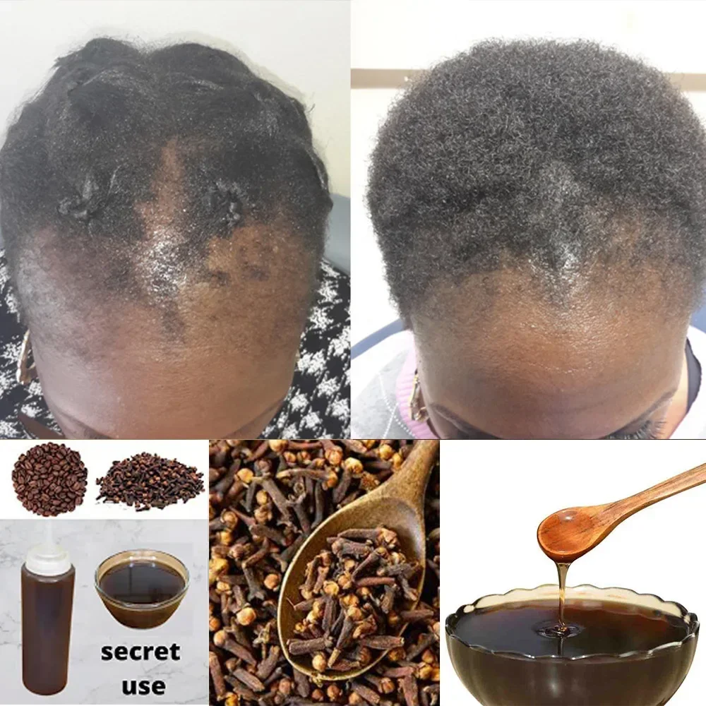 Hair Care Ginseng - منتج لنمو الشعر للرجال والنساء ،