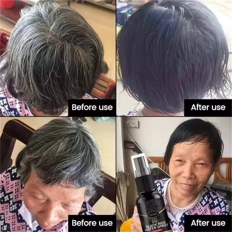 سيروم علاج الشعر الرمادي الأبي - مراجعة Hair Care Ginseng وسعره