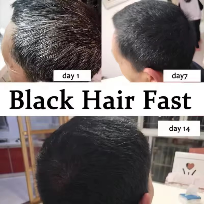سيروم علاج الشعر الرمادي الأبي - مراجعة Hair Care Ginseng وسعره