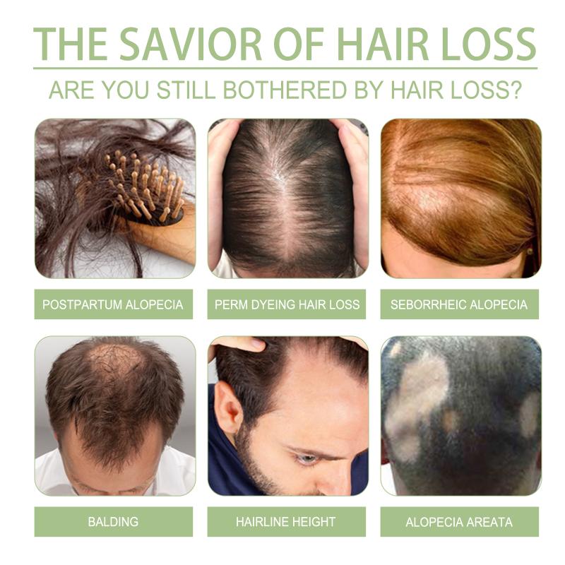 زيت جديد لنمو الشعر سعة 100 مل - مراجعة Hair Care India وسعره