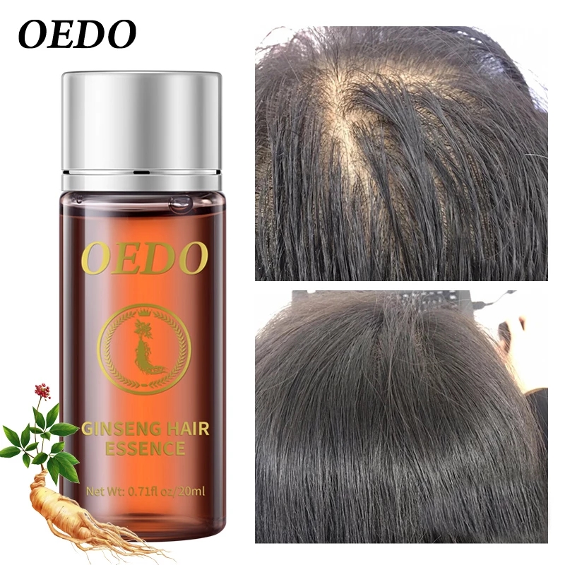 20 مللي الجينسنغ جوهر نمو الشع - مراجعة Hair Care Ginseng وسعره