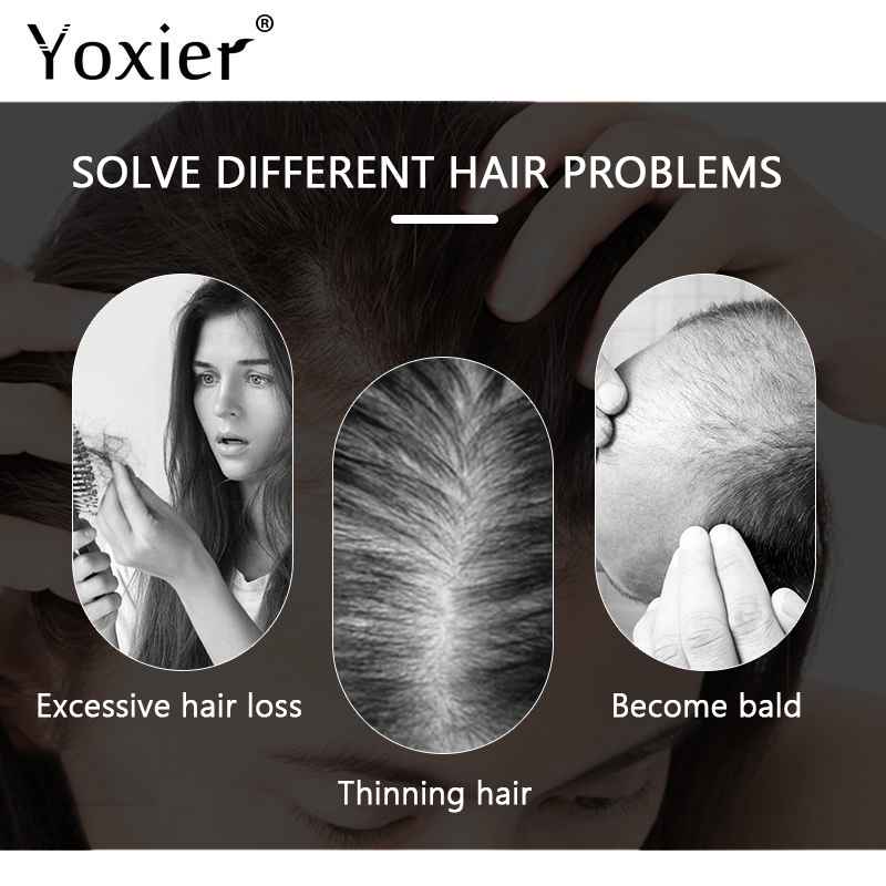 سيروم نمو مكثف يمنع تساقط الشع - مراجعة Hair Care Treatment وسعره