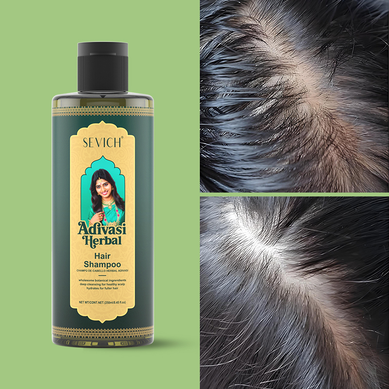 مجموعة زيت نمو الشعر العشبي من - مراجعة Hair Care India وسعره