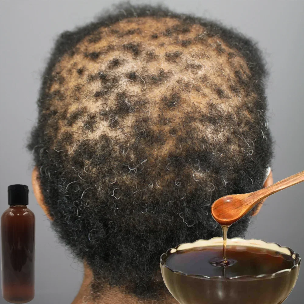 منتج لنمو الشعر للرجال والنساء - مراجعة Hair Care Ginseng وسعره
